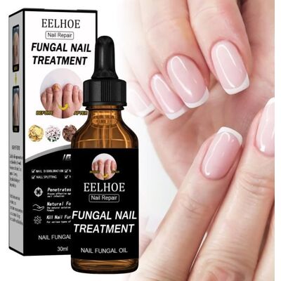 Solution fongique pour les ongles Extra forte Pour les doigts et les orteils Thérapie fongique Couche de - Publicité Solution fongique pour les ongles Extra forte Pour les doigts et les orteils Thérapie fongique Couche de - Publicité