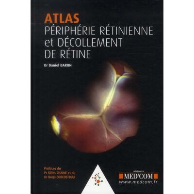 Atlas.peripherie retinienne. decollements de retine - Publicité Atlas.peripherie retinienne. decollements de retine - Publicité