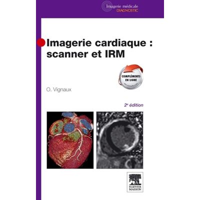 - PAS DE MARQUE - Imagerie cardiaque : scanner et IRM (2e édition) - Publicité - PAS DE MARQUE - Imagerie cardiaque : scanner et IRM (2e édition) - Publicité