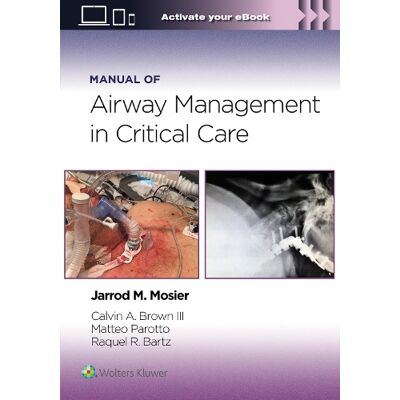 Jarrod Mosier, Calvin A Brown, Matteo Parotto, Raquel Rae Bartz, MOSIER, JARROD, Manual of Airway Management in Critical Care: Print + eBook with Multimedia - Publicité Jarrod Mosier, Calvin A Brown, Matteo Parotto, Raquel Rae Bartz, MOSIER, JARROD, Manual of Airway Management in Critical Care: Print + eBook with Multimedia - Publicité