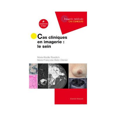 Cas cliniques en imagerie : le sein : + compléments en ligne - Publicité Cas cliniques en imagerie : le sein : + compléments en ligne - Publicité