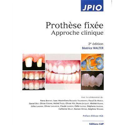 Béatrice Walter Prothèse fixée : approche clinique - Publicité Béatrice Walter Prothèse fixée : approche clinique - Publicité