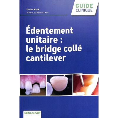 Florian Nadal Edentement unitaire : le bridge collé cantilever - Publicité Florian Nadal Edentement unitaire : le bridge collé cantilever - Publicité