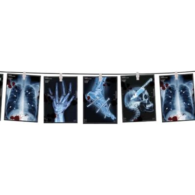 FIESTAS GUIRCA Décoration Guirlande Radios Médicales Papier 3 m Imprimés Médicaux Effrayants Léger, Facile À Suspendre 3 m Halloween, Carnaval & Soirées Déguisées - Publicité FIESTAS GUIRCA Décoration Guirlande Radios Médicales Papier 3 m Imprimés Médicaux Effrayants Léger, Facile À Suspendre 3 m Halloween, Carnaval & Soirées Déguisées - Publicité