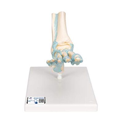 3B Scientific ® Pied Squelettique avec Ligaments – Modèle Anatomique Humain Taille Réelle + Smart Anatomy App (Garantie de 5 Ans) - Publicité 3B Scientific ® Pied Squelettique avec Ligaments – Modèle Anatomique Humain Taille Réelle + Smart Anatomy App (Garantie de 5 Ans) - Publicité
