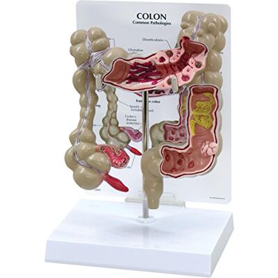 3B Scientific GPI Anatomicals W33364 Modèle de côlon - Publicité 3B Scientific GPI Anatomicals W33364 Modèle de côlon - Publicité