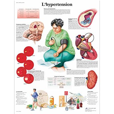 3B Scientific – Tableau Laminé de l’Hypertension – Affiche d’Anatomie & Pathologie Protégée contre les UV et la Poussière pour Étude, Enseignement & Cliniques - Publicité 3B Scientific – Tableau Laminé de l’Hypertension – Affiche d’Anatomie & Pathologie Protégée contre les UV et la Poussière pour Étude, Enseignement & Cliniques - Publicité