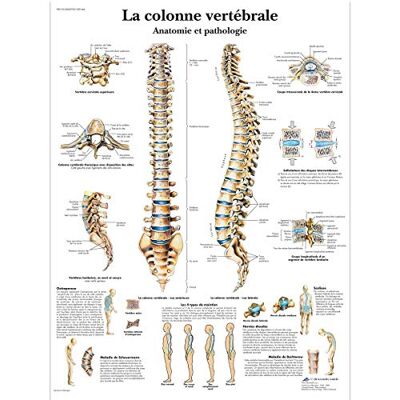 3B Scientific Affiche anatomique de la colonne vertébrale et pathologies en français, pour médecine, kinésithérapie, orthopédie et formation santé - Publicité 3B Scientific Affiche anatomique de la colonne vertébrale et pathologies en français, pour médecine, kinésithérapie, orthopédie et formation santé - Publicité