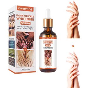 Fengyang ® Sérum éclaircissant pour les Articulations, Essence de blanchiment Forte, Sérum Blanchissant pour les Articulations du Corps pour L'articulation des Coude - Publicité Fengyang ® Sérum éclaircissant pour les Articulations, Essence de blanchiment Forte, Sérum Blanchissant pour les Articulations du Corps pour L'articulation des Coude - Publicité