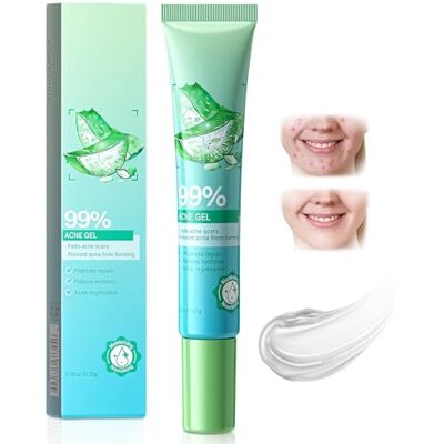 Yagaspantery 25g Anti-Boutons Gel,Gel Nettoyant Anti-Boutons,Crème Anti Acné,pour Réduit les BoutonsImperfections Localisées,Convient Aussi Bien Aux Hommes Qu'aux Femmes - Publicité Yagaspantery 25g Anti-Boutons Gel,Gel Nettoyant Anti-Boutons,Crème Anti Acné,pour Réduit les BoutonsImperfections Localisées,Convient Aussi Bien Aux Hommes Qu'aux Femmes - Publicité