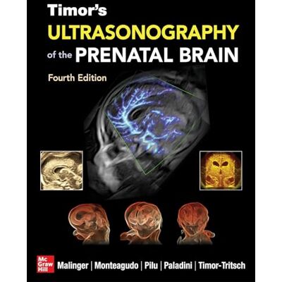 Malinger, Gustavo Timor's Ultrasonography of the Prenatal Brain - Publicité Malinger, Gustavo Timor's Ultrasonography of the Prenatal Brain - Publicité
