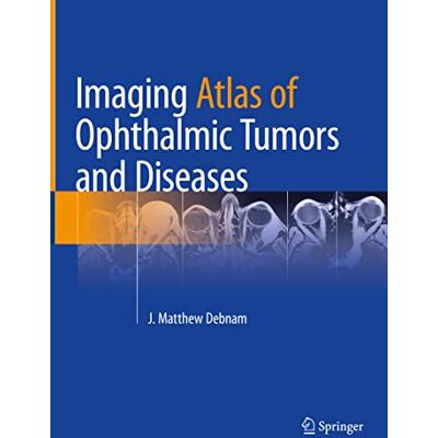 Imaging Atlas of Ophthalmic Tumors and Diseases - Publicité Imaging Atlas of Ophthalmic Tumors and Diseases - Publicité