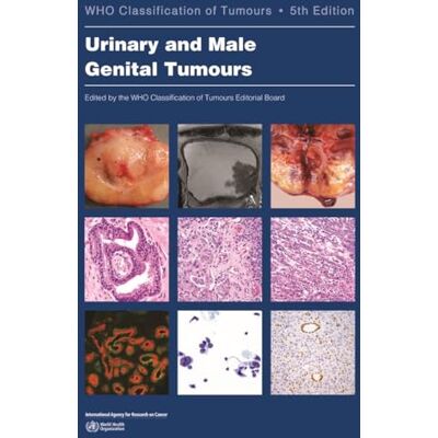 International Agency for Research on Cancer Urinary and Male Genital Tumours - Publicité International Agency for Research on Cancer Urinary and Male Genital Tumours - Publicité