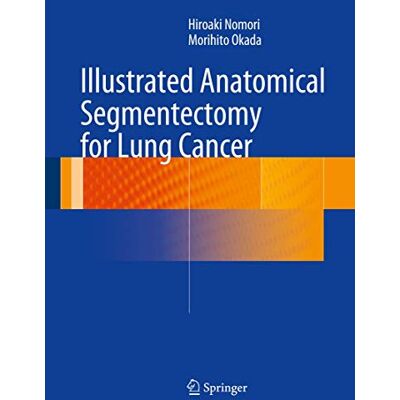 Nomori, Hiroaki Illustrated Anatomical Segmentectomy for Lung Cancer - Publicité Nomori, Hiroaki Illustrated Anatomical Segmentectomy for Lung Cancer - Publicité