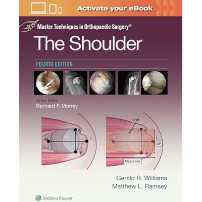 WILLIAMS JR. MD, GERALD R. Master Techniques in Orthopaedic Surgery: The Shoulder: Print + eBook with Multimedia - Publicité WILLIAMS JR. MD, GERALD R. Master Techniques in Orthopaedic Surgery: The Shoulder: Print + eBook with Multimedia - Publicité