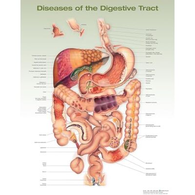Anatomical Chart Company Diseases of the Digestive Tract Anatomical Chart - Publicité Anatomical Chart Company Diseases of the Digestive Tract Anatomical Chart - Publicité