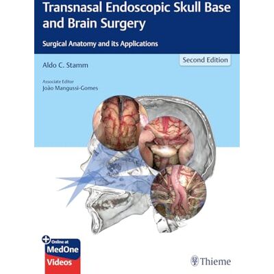Transnasal Endoscopic Skull Base and Brain Surgery: Surgical Anatomy and Its Applications - Publicité Transnasal Endoscopic Skull Base and Brain Surgery: Surgical Anatomy and Its Applications - Publicité