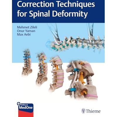 Correction Techniques for Spinal Deformity - Publicité Correction Techniques for Spinal Deformity - Publicité