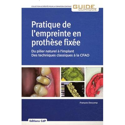 Descamp, François Pratique de l'empreinte en prothèse fixée: Du pilier naturel à l'implant Des techniques classiques à la CFAO - Publicité Descamp, François Pratique de l'empreinte en prothèse fixée: Du pilier naturel à l'implant Des techniques classiques à la CFAO - Publicité