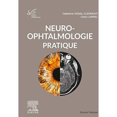 Société Française d'Ophtalmologie (SFO) Neuro-ophtalmologie pratique: Rapport SFO 2020 - Publicité Société Française d'Ophtalmologie (SFO) Neuro-ophtalmologie pratique: Rapport SFO 2020 - Publicité