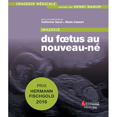 NAHUM, Henri Imagerie : du foetus au nouveau-né - Publicité NAHUM, Henri Imagerie : du foetus au nouveau-né - Publicité