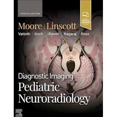 Moore MD, Kevin R. Diagnostic Imaging: Pediatric Neuroradiology - Publicité Moore MD, Kevin R. Diagnostic Imaging: Pediatric Neuroradiology - Publicité