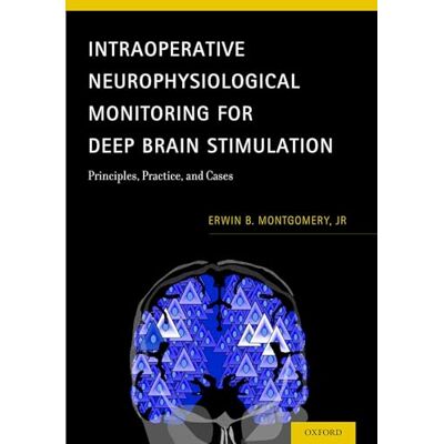Montgomery Jr, Erwin B. Intraoperative Neurophysiological Monitoring for Deep Brain Stimulation: Principles, Practice, and Cases - Publicité Montgomery Jr, Erwin B. Intraoperative Neurophysiological Monitoring for Deep Brain Stimulation: Principles, Practice, and Cases - Publicité