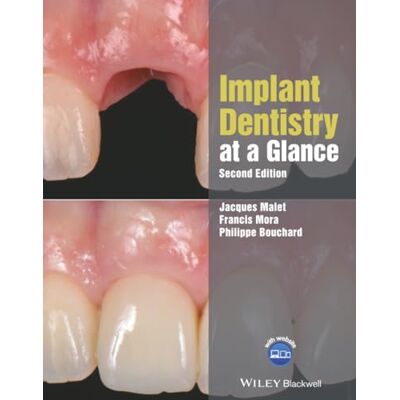 Malet, Jacques Implant Dentistry at a Glance - Publicité Malet, Jacques Implant Dentistry at a Glance - Publicité