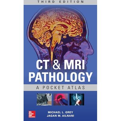 GREY CT & MRI Pathology: A Pocket Atlas, Third Edition - Publicité GREY CT & MRI Pathology: A Pocket Atlas, Third Edition - Publicité