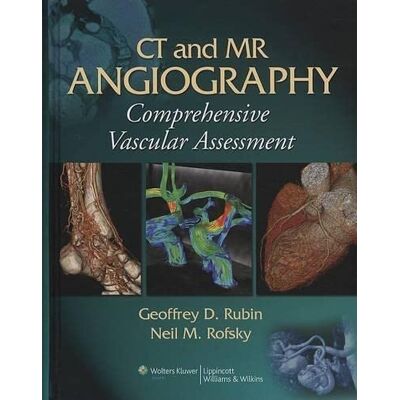 Ct And Mr Angiography: Comprehensive Vascular Assessment - Publicité Ct And Mr Angiography: Comprehensive Vascular Assessment - Publicité