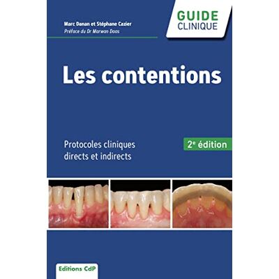 Cazier, Stéphane Les contentions: Protocoles cliniques directs et indirects - Publicité Cazier, Stéphane Les contentions: Protocoles cliniques directs et indirects - Publicité