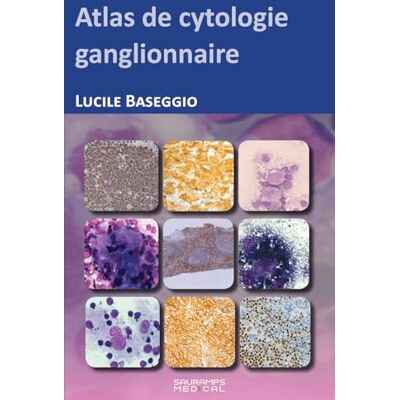 BASEGGIO LUCILE ATLAS DE CYTOPATHOLOGIE GANGLIONNAIRE - Publicité BASEGGIO LUCILE ATLAS DE CYTOPATHOLOGIE GANGLIONNAIRE - Publicité