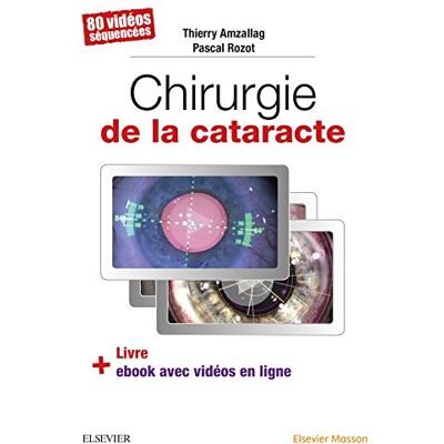 Amzallag, Docteur Thierry Chirurgie de la cataracte: 60 Videos Sequencees - Publicité Amzallag, Docteur Thierry Chirurgie de la cataracte: 60 Videos Sequencees - Publicité