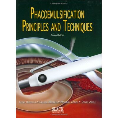 Buratto, Lucio Phacoemulsification: Principles and Techniques - Publicité Buratto, Lucio Phacoemulsification: Principles and Techniques - Publicité