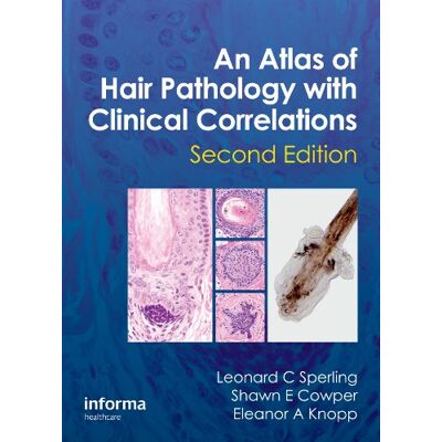Sperling, Leonard C. An Atlas of Hair Pathology With Clinical Correlations - Publicité Sperling, Leonard C. An Atlas of Hair Pathology With Clinical Correlations - Publicité