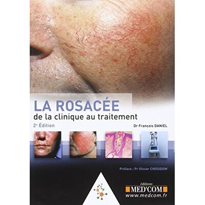 Daniel, François LA ROSACEE. DE LA CLINIQUE AU TRAITEMENT (0000) - Publicité Daniel, François LA ROSACEE. DE LA CLINIQUE AU TRAITEMENT (0000) - Publicité