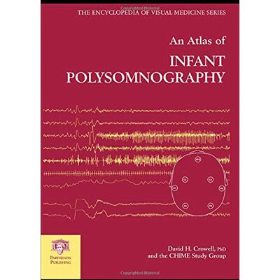 Crowell, David Harrison An Atlas of Infant Polysomnography - Publicité Crowell, David Harrison An Atlas of Infant Polysomnography - Publicité