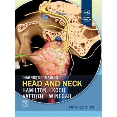 Hamilton MD, Bronwyn E. Diagnostic Imaging: Head and Neck - Publicité Hamilton MD, Bronwyn E. Diagnostic Imaging: Head and Neck - Publicité