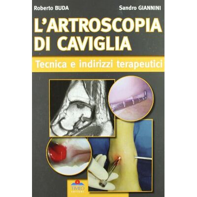 Giannini, Sandro L'artroscopia di caviglia. Tecnica e indirizzi terapeutici - Publicité Giannini, Sandro L'artroscopia di caviglia. Tecnica e indirizzi terapeutici - Publicité
