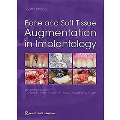 Khoury, Fouad Bone and Soft Tissue Augmentation in Implantology - Publicité Khoury, Fouad Bone and Soft Tissue Augmentation in Implantology - Publicité