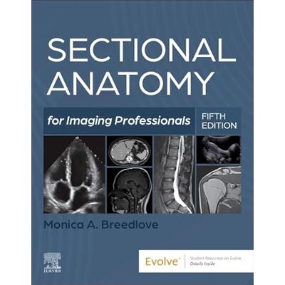 Breedlove M.Ed. RT(R)(M)(CT)(MR), Monica Sectional Anatomy for Imaging Professionals - Publicité Breedlove M.Ed. RT(R)(M)(CT)(MR), Monica Sectional Anatomy for Imaging Professionals - Publicité