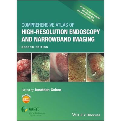 Comprehensive Atlas of High-Resolution Endoscopy and Narrowband Imaging - Publicité Comprehensive Atlas of High-Resolution Endoscopy and Narrowband Imaging - Publicité