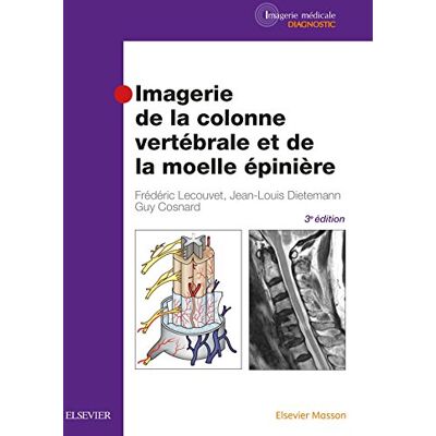 Lecouvet, Frédéric Imagerie de la colonne vertébrale et de la moelle épinière - Publicité Lecouvet, Frédéric Imagerie de la colonne vertébrale et de la moelle épinière - Publicité