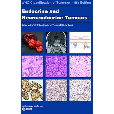 World Health Organization: International Agency for Research on Cancer Endocrine and Neuroendocrine Tumours - Publicité World Health Organization: International Agency for Research on Cancer Endocrine and Neuroendocrine Tumours - Publicité