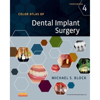 Block DMD, Michael S. Color Atlas of Dental Implant Surgery - Publicité Block DMD, Michael S. Color Atlas of Dental Implant Surgery - Publicité