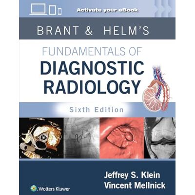 Klein MD FACR, Jeffrey Brant & Helms' Fundamentals of Diagnostic Radiology: Print + eBook with Multimedia - Publicité Klein MD FACR, Jeffrey Brant & Helms' Fundamentals of Diagnostic Radiology: Print + eBook with Multimedia - Publicité