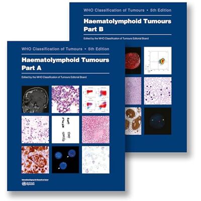 UK Government Haematolymphoid Tumours: Who Classification of Tumours - Publicité UK Government Haematolymphoid Tumours: Who Classification of Tumours - Publicité