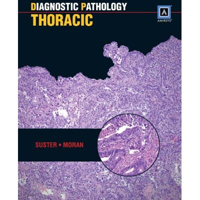 Suster, Saul Diagnostic Pathology: Thoracic: Published by Amirsys (R) - Publicité Suster, Saul Diagnostic Pathology: Thoracic: Published by Amirsys (R) - Publicité