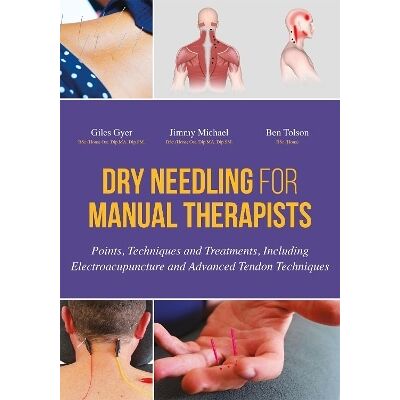 Dry Needling for Manual Therapists: Points, Techniques and Treatments, Including Electroacupuncture and Advanced Tendon Techniques Ben Tolson Singing Dragon Dry Needling for Manual Therapists: Points, Techniques and Treatments, Including Electroacupuncture and Advanced Tendon Techniques Ben Tolson Singing Dragon
