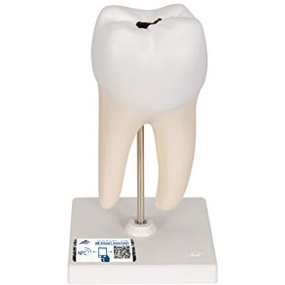 3B Scientific Menschliche Anatomie Unterer zweiwurzeliger Molar mit Karies, 2-teilig + kostenlose Anatomie App 3B Smart Anatomy 3B Scientific Menschliche Anatomie Unterer zweiwurzeliger Molar mit Karies, 2-teilig + kostenlose Anatomie App 3B Smart Anatomy